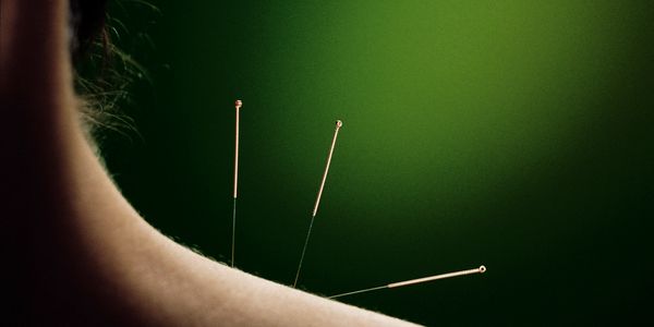 Acupuncture for shoulder pain 