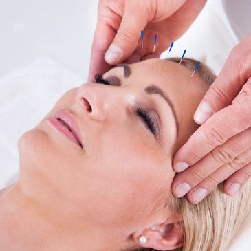 acupuncture, facial, facial rejuvenation