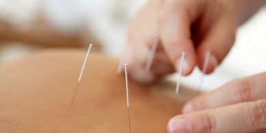 Acupuncture Chinese Doctor, acupuncture Sydney, IVF acupuncture Sydney 