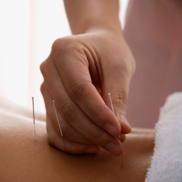 acupuncture, pain, women's health 