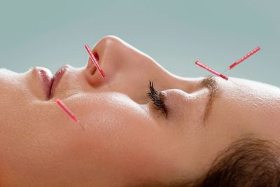 Cosmetic Acupuncture
Facial Acupuncture