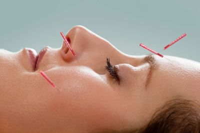 We offer Cosmetic Acupuncture covering Etobicoke, Mississauga, Toronto and Brampton area.