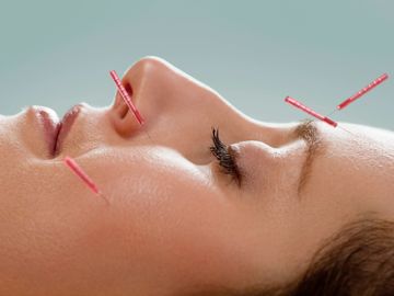 Woman receiving facial Acupuncture
