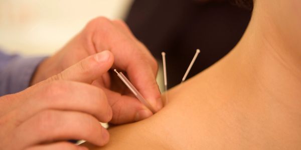 Best acupuncturist  help emotional disorder#anxiety#depression#shoulder pain#Neck pain#back pain 
