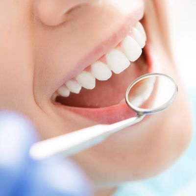 L'examen dentaire est effectuée par un dentiste pour évaluer la santé bucco-dentaire d'un patient.