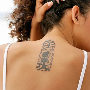 Medium tattoo pricing. Point Blank Tattoo Removal
