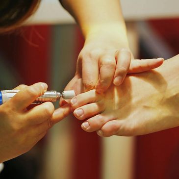 Chiropodist reducing thickened nails