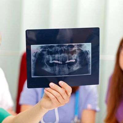 Dental team reviewing x-rays