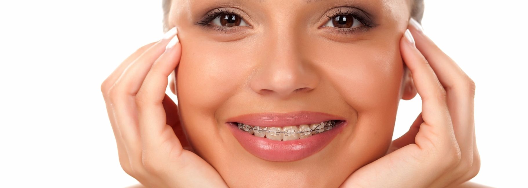 Ceramic braces helping to create a beautiful smile!