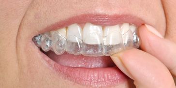 Clear Aligner Therapy
Invisalign
Clear Correct