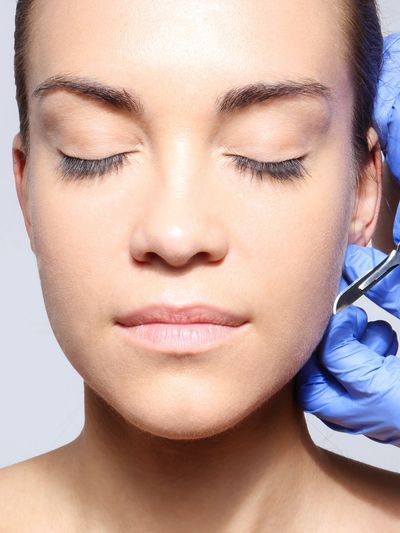 Woman's face being derma-planed with a scalpel