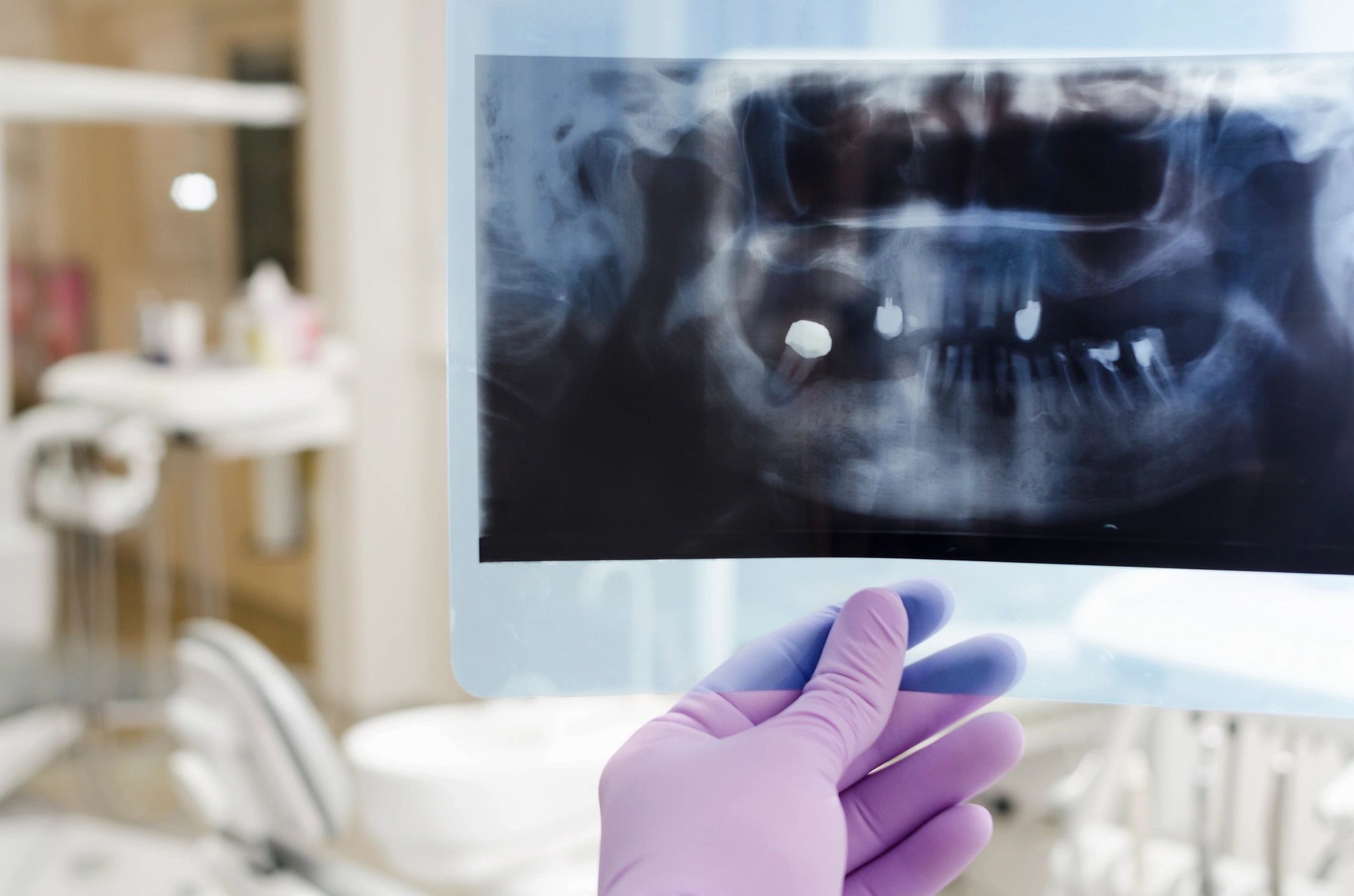 Dental Implant Ctr-Ne Kansas