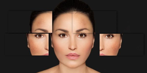 Botox, Dermal Fillers, Lips fillers, Fat dissolving injections