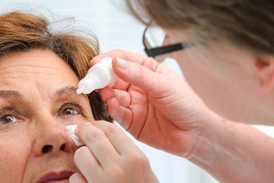 A lady being treated for chronic dry eye with autologous eye serum