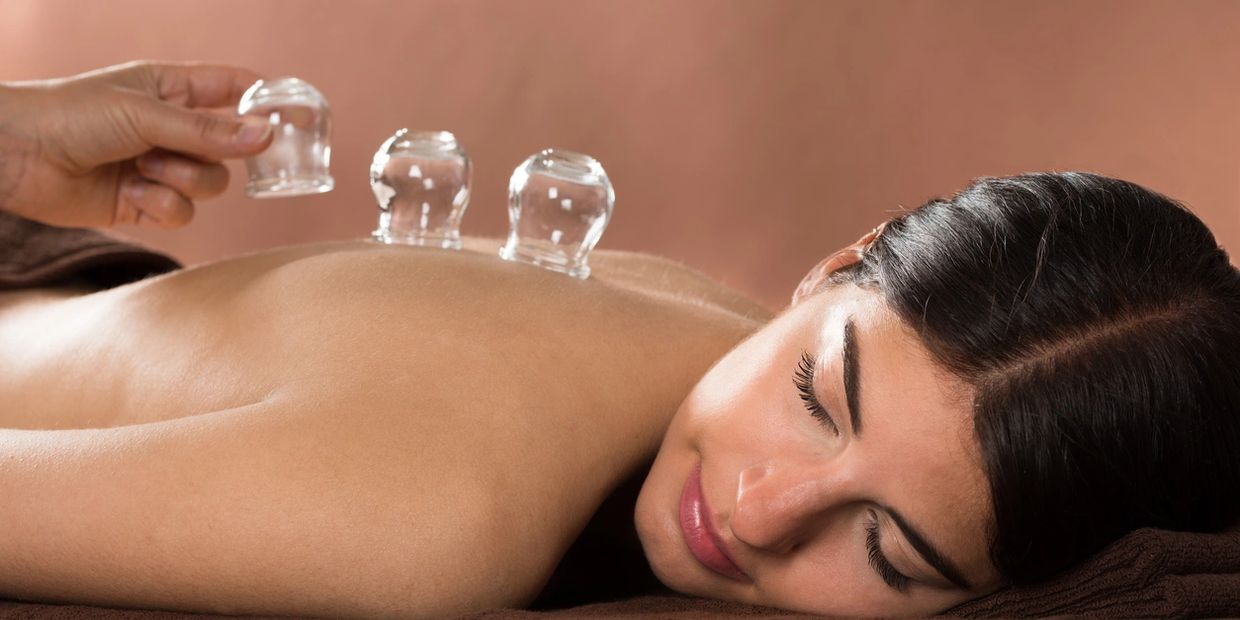 A woman is receiving cupping therapy with three glass cups