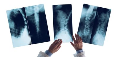 spine radiographic x-ray images