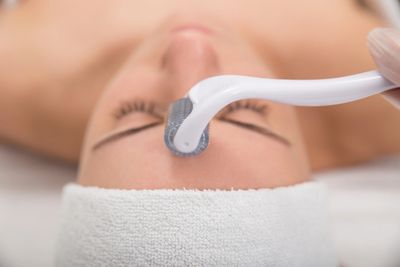 This is manual microneedling.  We use an actual  micropen to create small micro channels in the skin