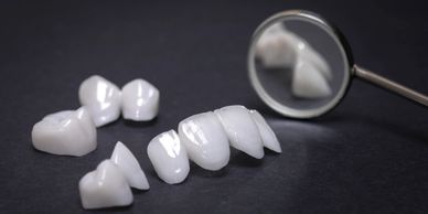 Wendover Dental Crowns