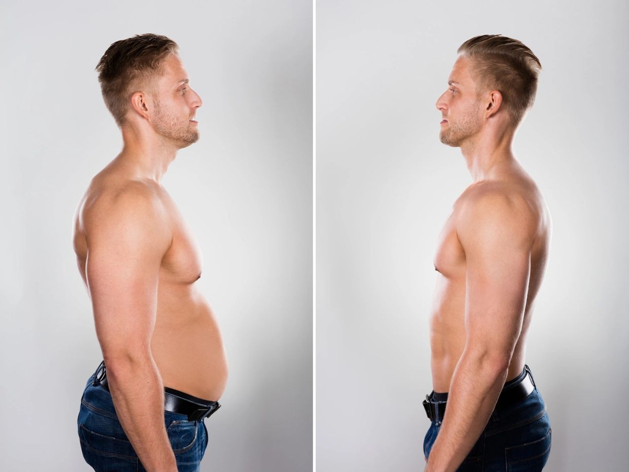 Semaglutide L-Carnitine weight loss program before and after picture.