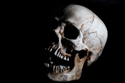 So you got stabbed at laughing Koffin? Happens to the best of us.