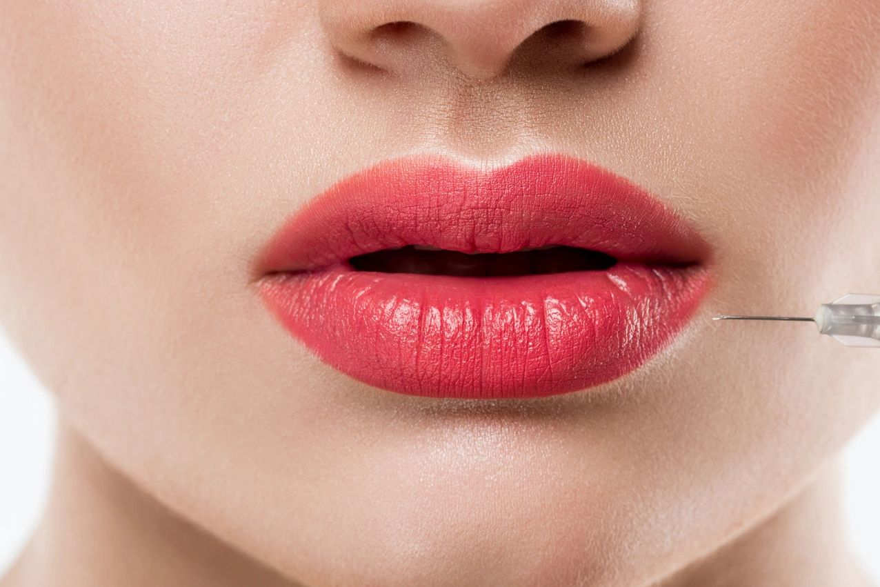 alt="Dermal fillers  Oswego IL serving Yorkville, Aurora, and Naperville at Hello Gorgeous Med Spa"
