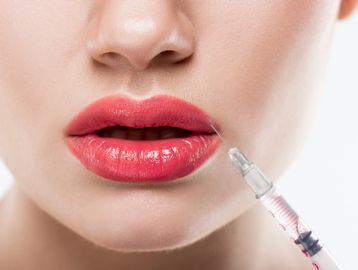 A close-up of lips receiving a cosmetic injection.