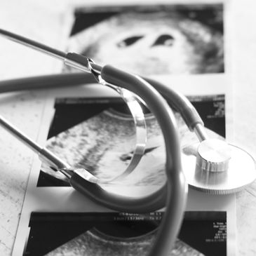 Stethoscope lying on ultrasound images on a white surface.