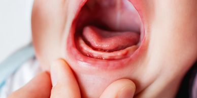 Close-up of a baby or toddler's open mouth with visible gums.