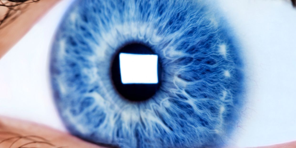 Keratopigmentation Surgery Indiana 424-478-9157