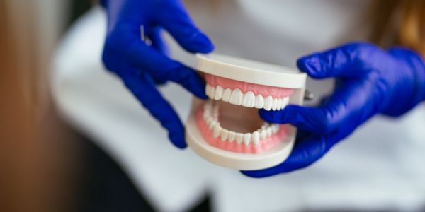 Hands in blue gloves holding a dental model.