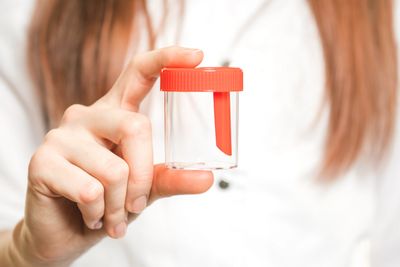Hand holding a small transparent medical specimen container with a red lid.