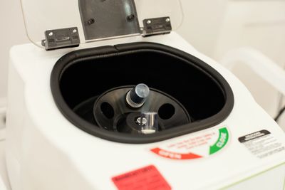 Close-up of a laboratory centrifuge with its lid open.