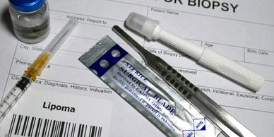 Medical tools and biopsy report with lipoma diagnosis.