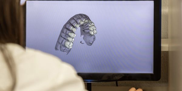 Person analyzing a 3D dental model on a computer screen.