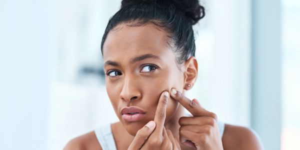 A woman squeezing a pimple on her cheek in a bright room.
