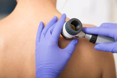 Dermatologist examining skin with a dermatoscope.