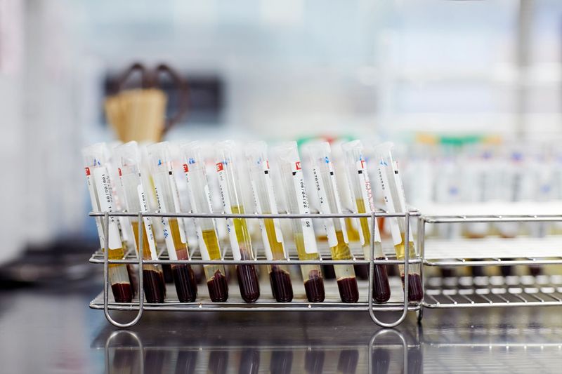 Close-up of medical samples on desk. Test tubes are with labels. It is in laboratory.