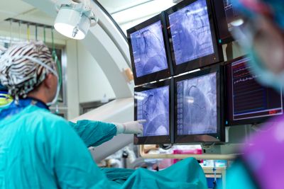 Doctors examining heart X-rays on monitors during surgery.