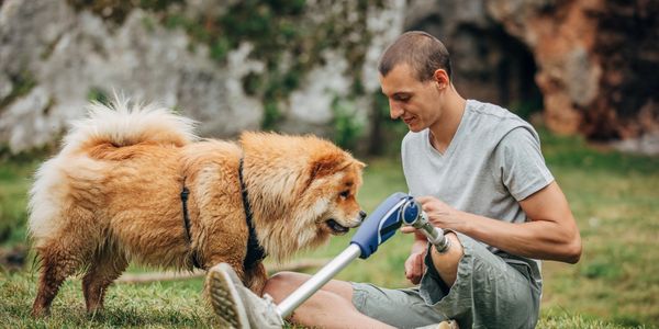 Man with prosthetic leg playing with a dog.