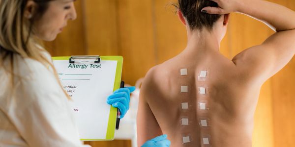 Allergy test with patches on patient's back.