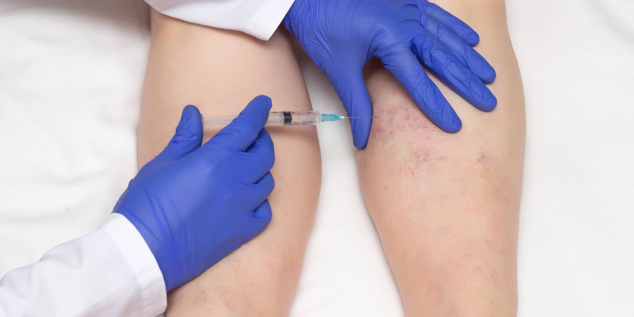 Bas après injections veineuses disponibles avec service professionnel chez Gagnon Bas Médicaux