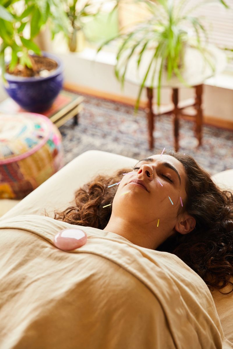 Serene young brunette woman getting acupuncture done on her face while lying on a table in an alternative medicine clinic