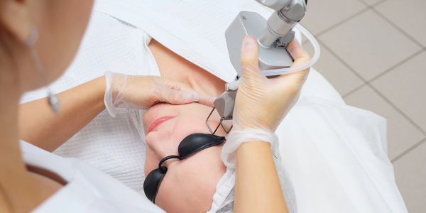 Depilacion definitiva con IPL en el rostro en Oaxaca.