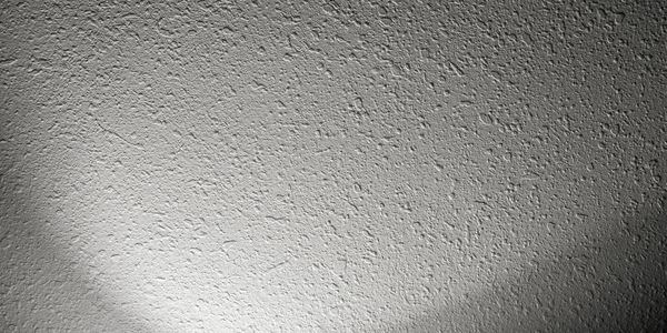 A sad-looking popcorn ceiling