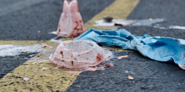 Discarded blood-stained medical gloves on asphalt near yellow road line.