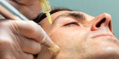 Close-up of a man receiving a facial injection and treatment.