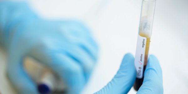 Healthcare worker performing TB skin test.