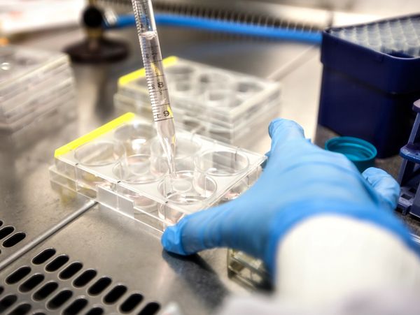 Scientist pipetting product for testing.