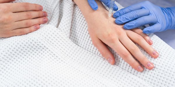 Radiesse® hand injections at Royal med spa for collagen production
