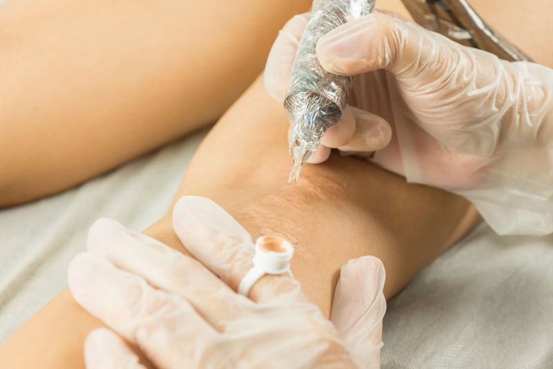 Scar camouflage therapy with rotative machine